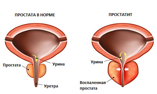 stroenie prostaty